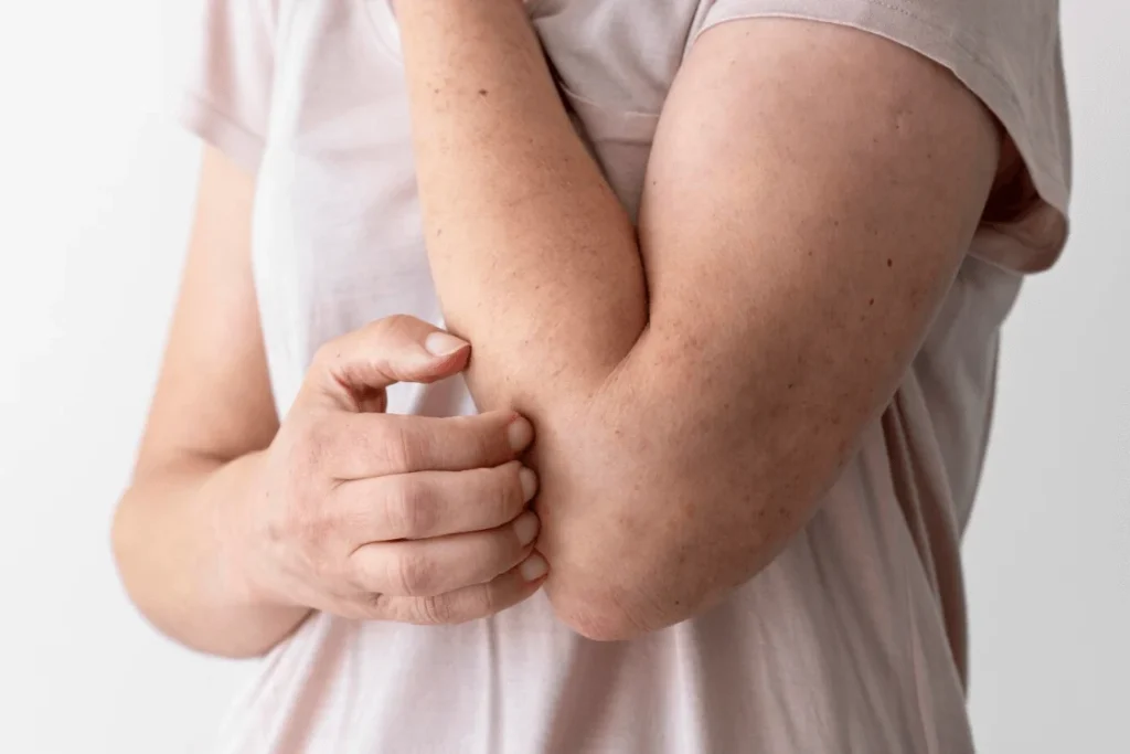 mujer rascándose el brazo