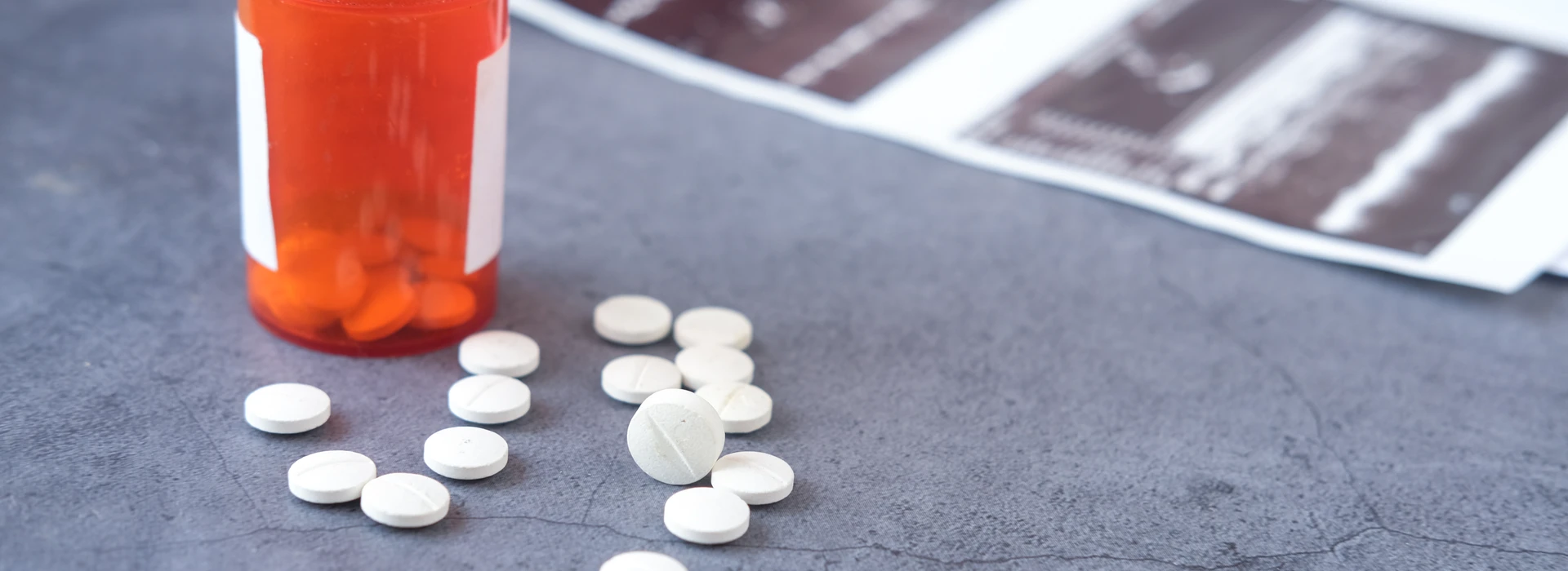 Sobredosis de Alprazolam